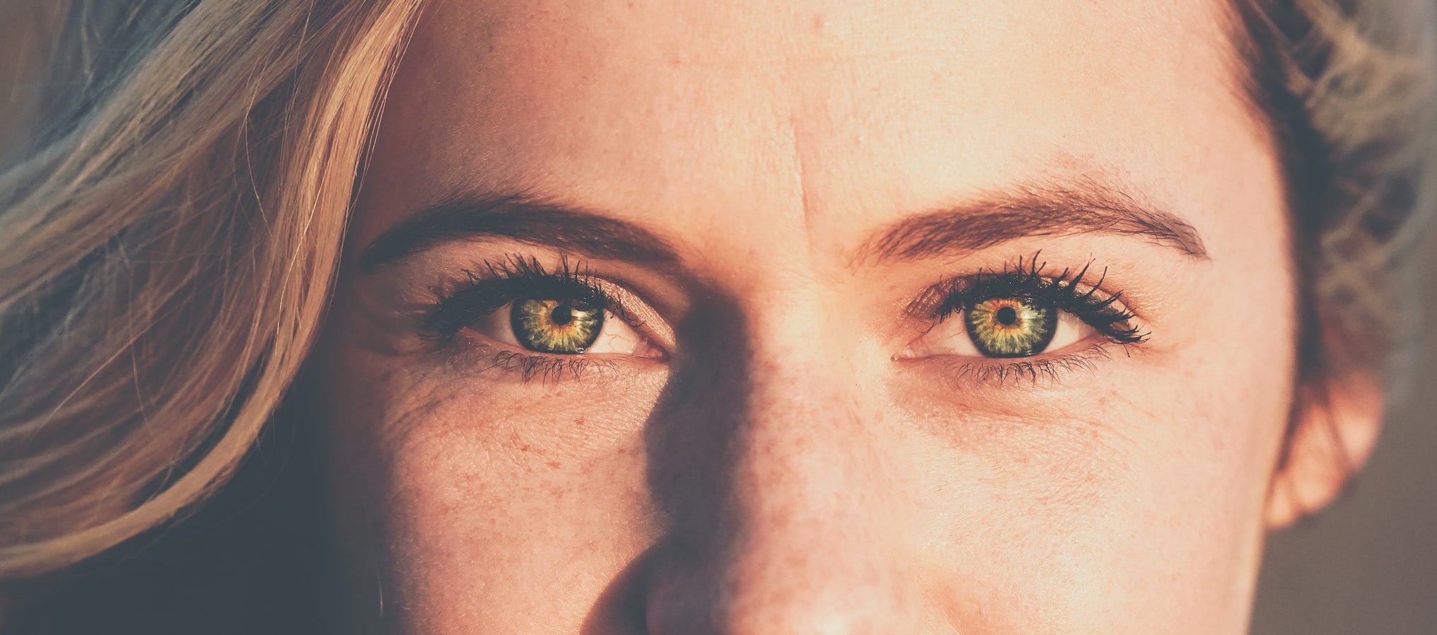 Can Sculptra Be Used Under the Eyes