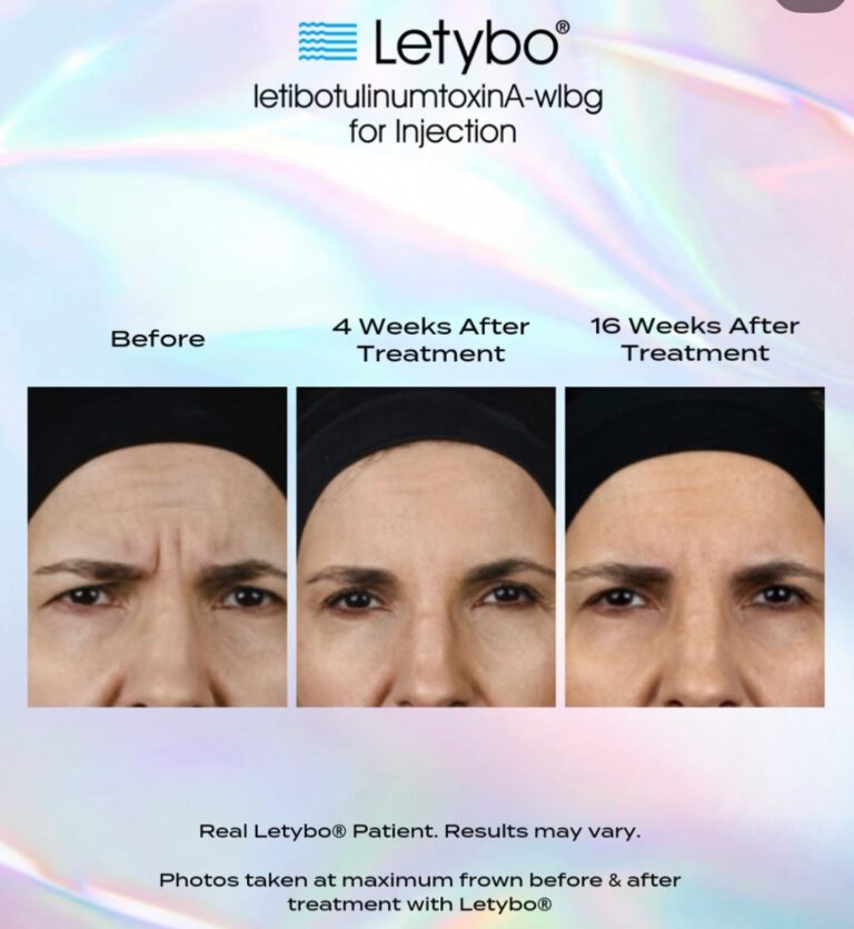 Letybo-before-after-photos-768x836